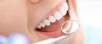 SorriOrto Dentista São Leopoldo - Tártaro e placa bacteriana Rio Grande do Sul