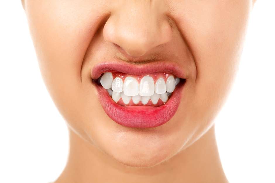 Mordida cruzada - Tratamento e causas - SorriOrto São Leopoldo Dentista