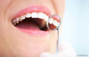 Sequela oral covid-19 - Dentista São Leopoldo SorriOrto