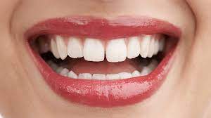 Diastema - Dentista São Leopoldo SorriOrto